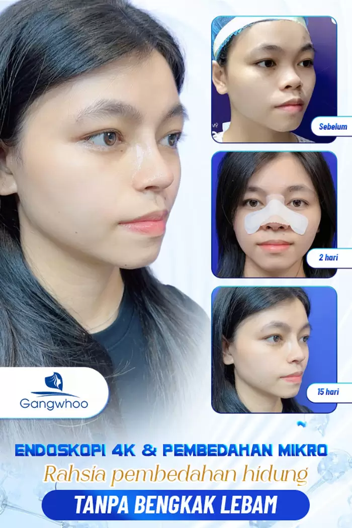 ms nang mui cau truc 6