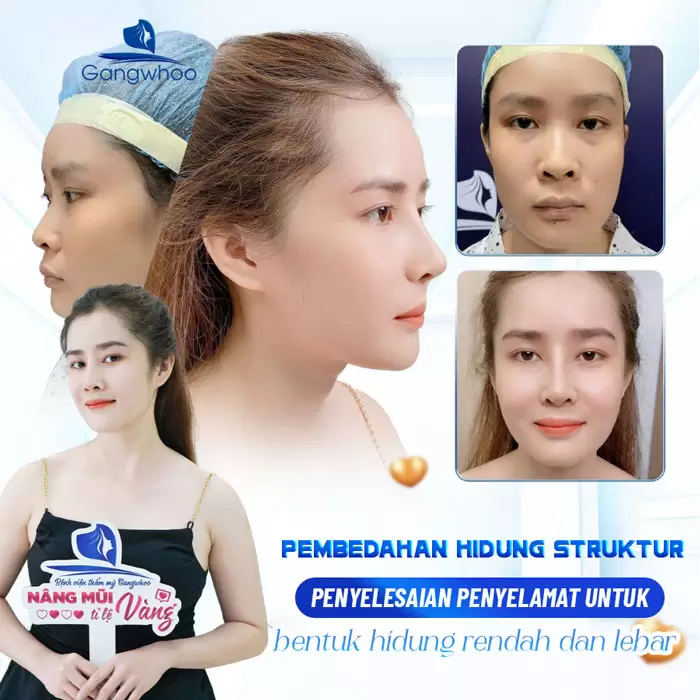 ms nang mui cau truc 7