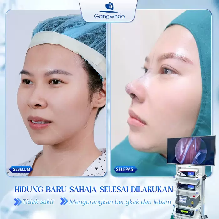 ms nang mui han quoc 6