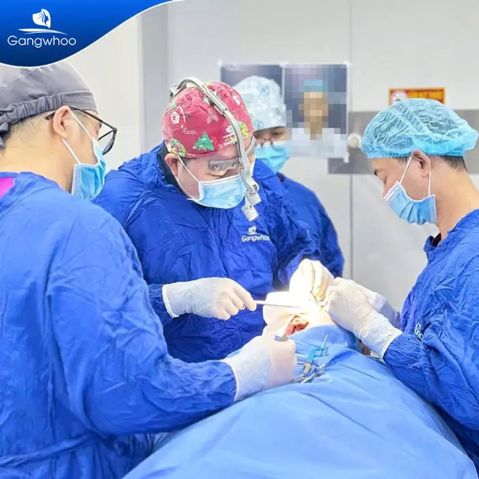 Pembentukan Hidung Surgiform – Tulang Rawan Pembentukan Hidung untuk Hidung yang Kukuh 5 ms nang mui sun surgiform 10