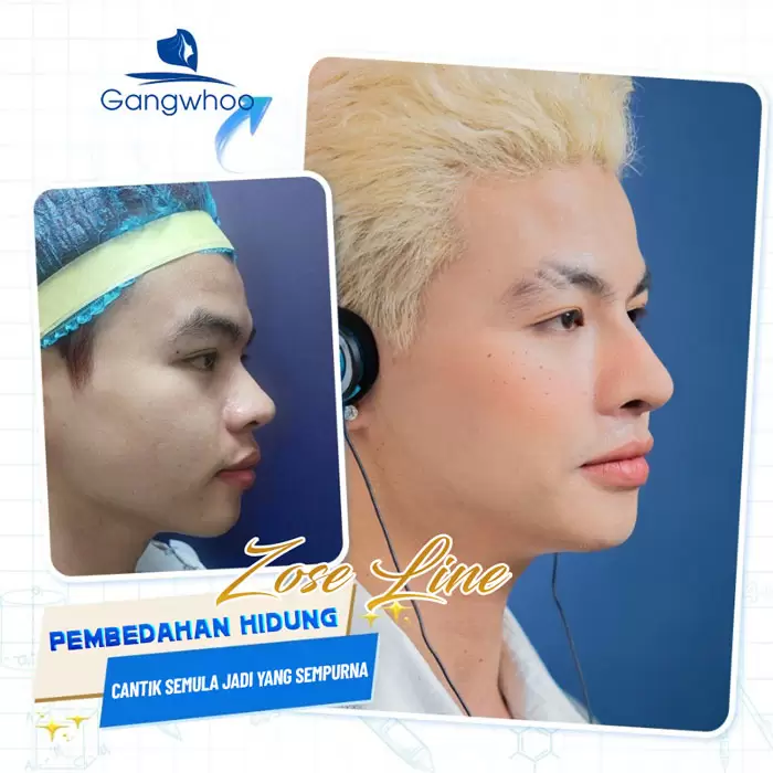 ms nang mui zose line 3