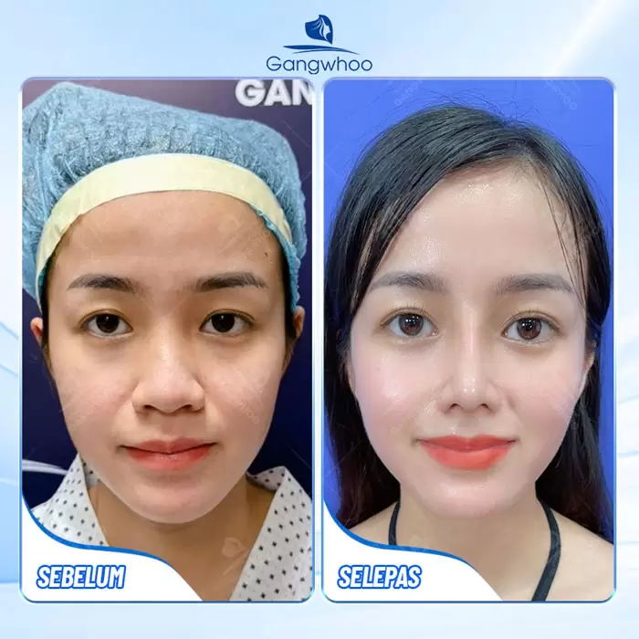 ms thu gon canh mui 1