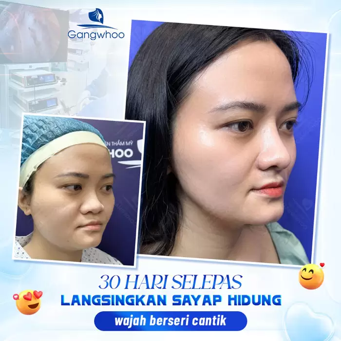 ms thu gon canh mui 3