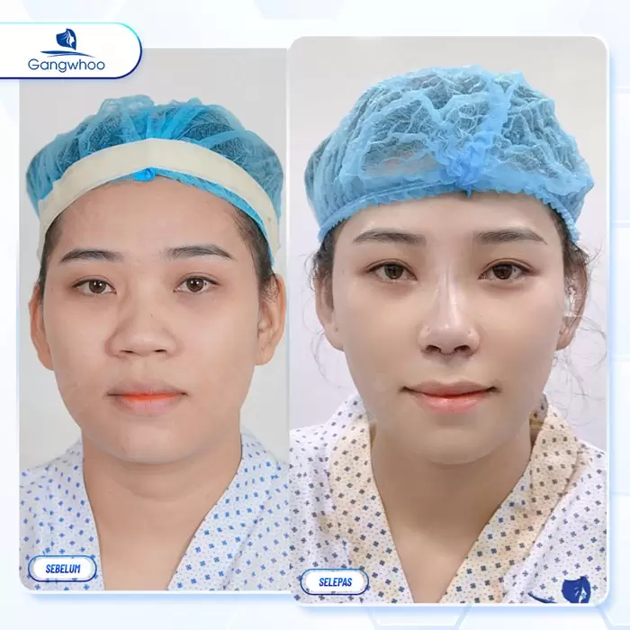 ms thu gon canh mui 5