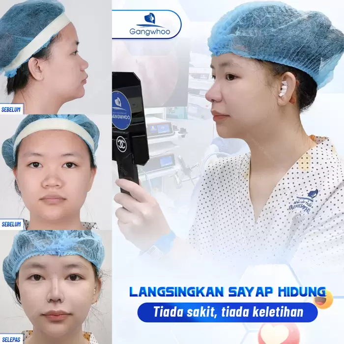 ms thu gon canh mui 6