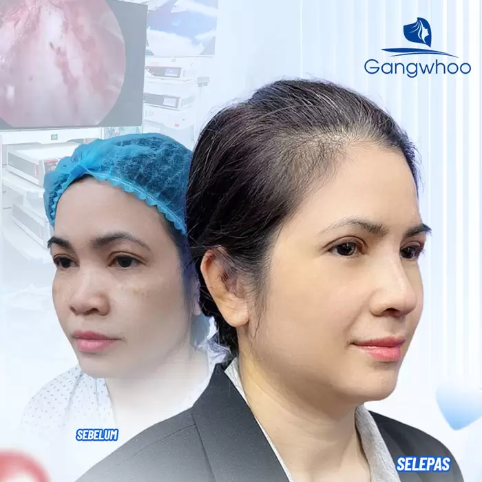 ms thu gon canh mui 7