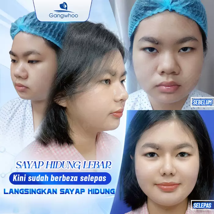 ms thu gon canh mui 8