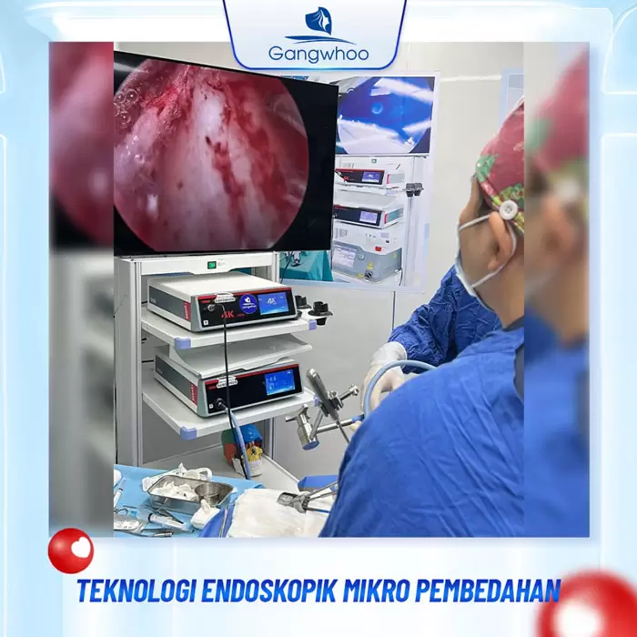 ms thu gon canh mui 9