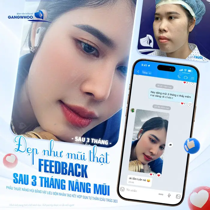 mui vao form dep nhu that sau 3 thang da vao form dep chaun