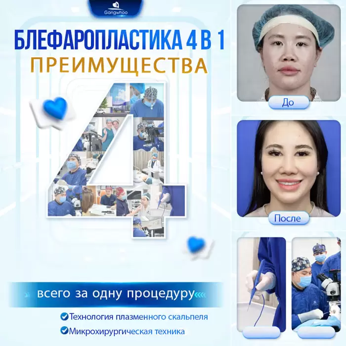 ru cat mi 4 in 9