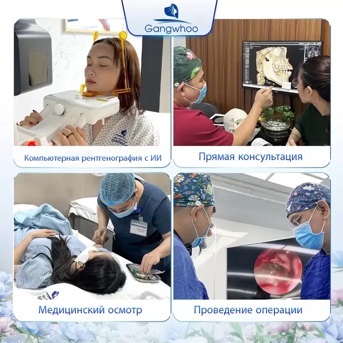 ru dieu tri liet mat 1