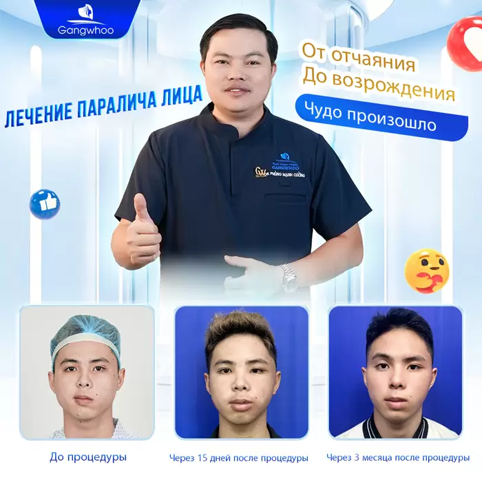 ru dieu tri liet mat 10