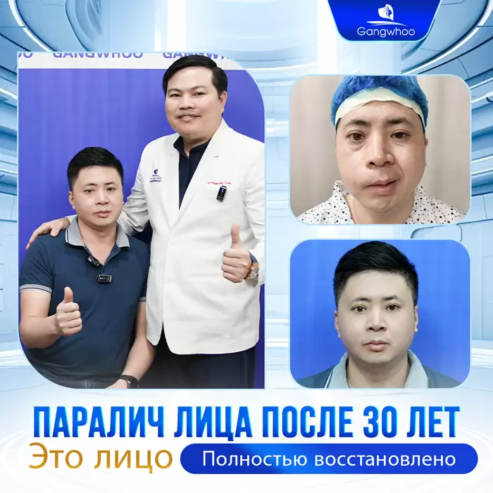 ru dieu tri liet mat 11