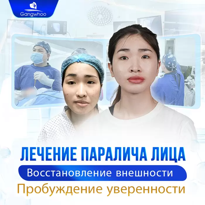 ru dieu tri liet mat 2