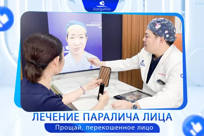 ru dieu tri liet mat 7