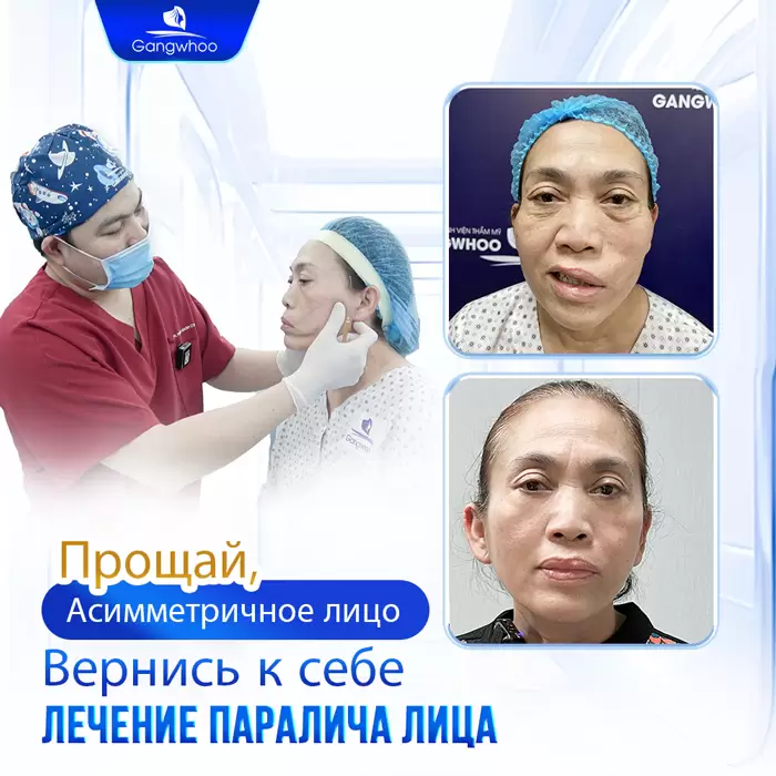 ru dieu tri liet mat 9