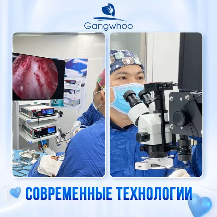 ru lay mo mat noi soi 5