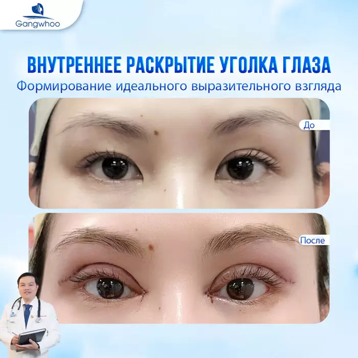 ru mo mi mat trong 3