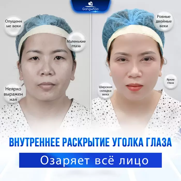 ru mo mi mat trong 5