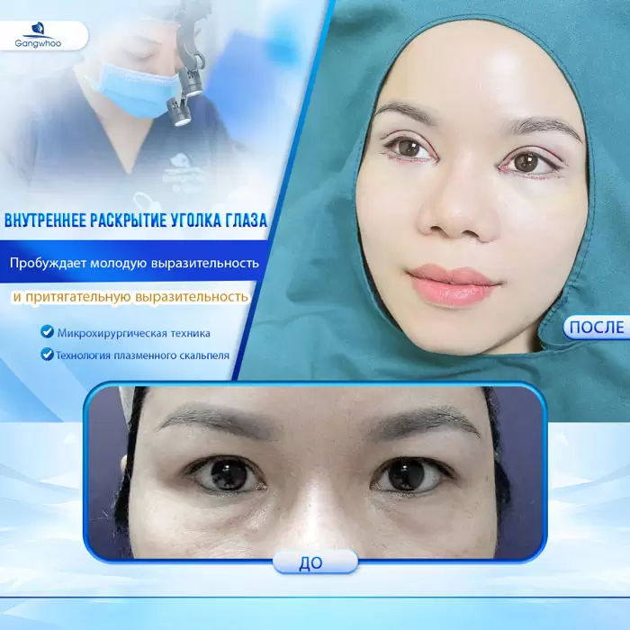 ru mo mi mat trong 6