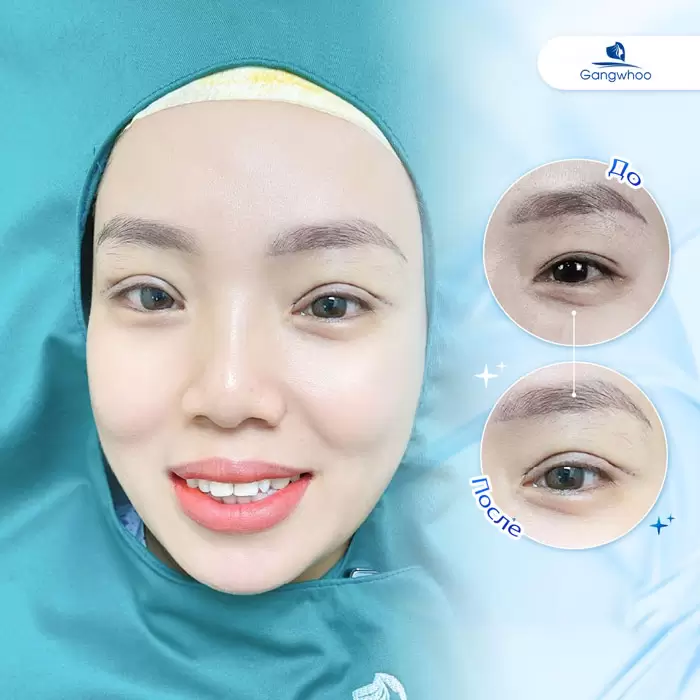 ru mo mi mat trong 7