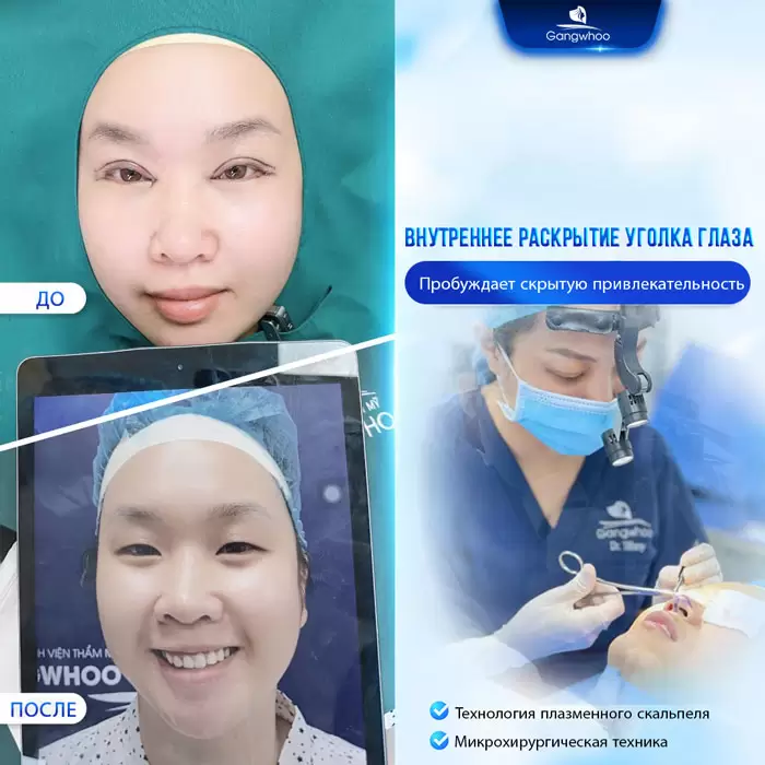 ru mo mi mat trong 8