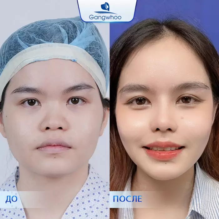 ru nang mui han quoc 3