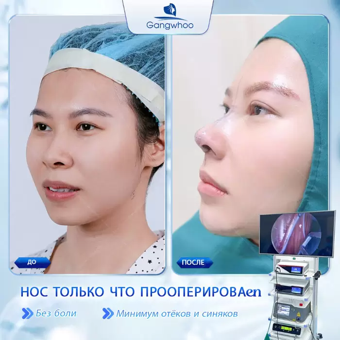 ru nang mui han quoc 6