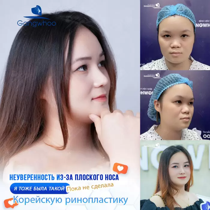 ru nang mui han quoc 8