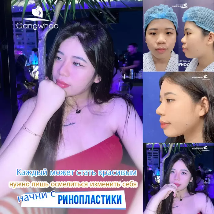 ru nang mui sun suon 10
