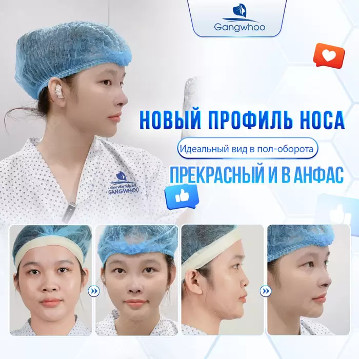 ru nang mui sun suon 2