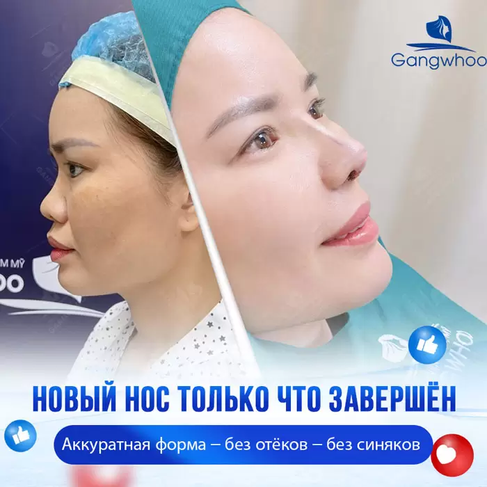ru nang mui sun suon 7
