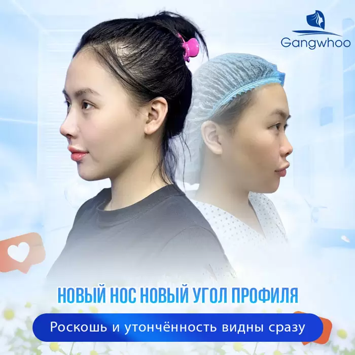 ru nang mui sun suon 9