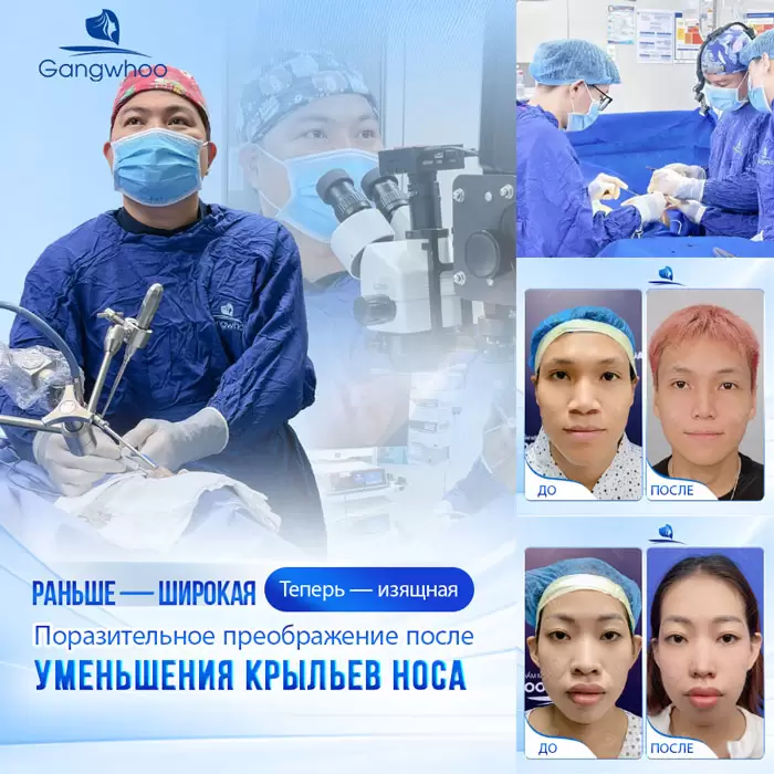 ru thu gon canh mui 2