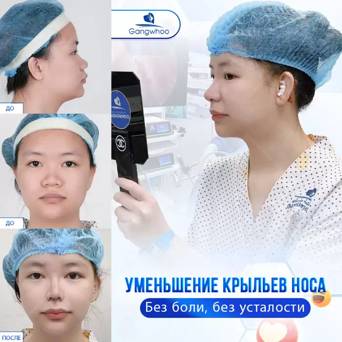 ru thu gon canh mui 6