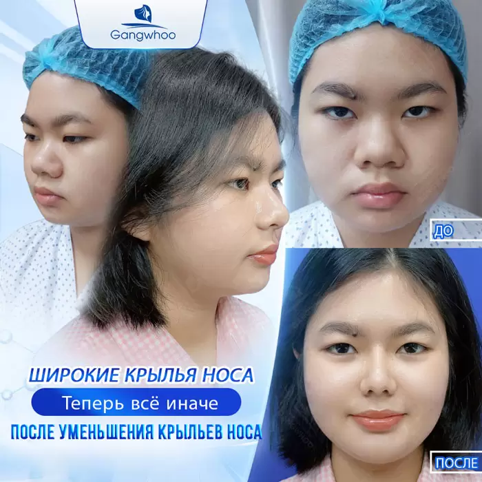 ru thu gon canh mui 8