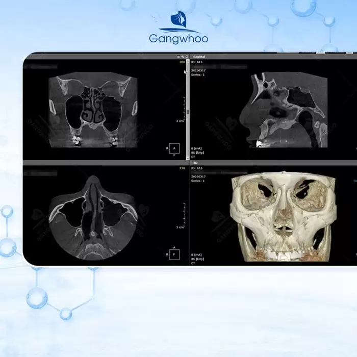 ru thu nho dau mui 1