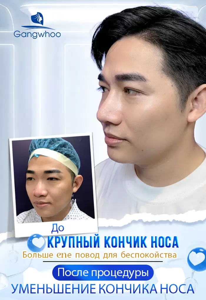 ru thu nho dau mui 3