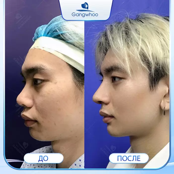 ru thu nho dau mui 4