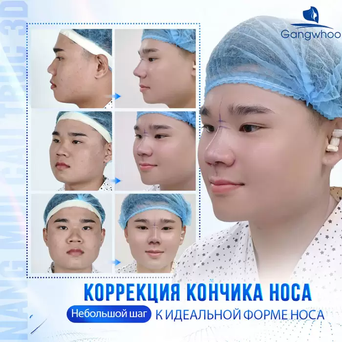 ru thu nho dau mui 5