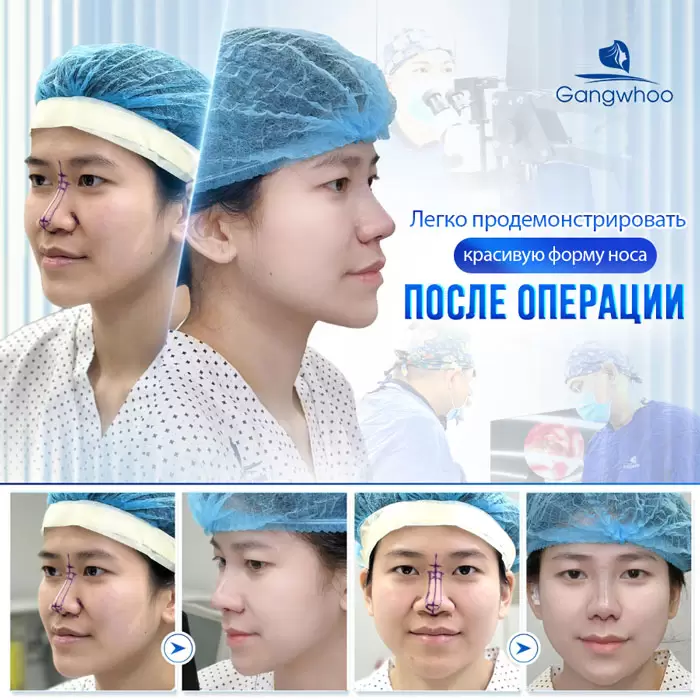 ru thu nho dau mui 6