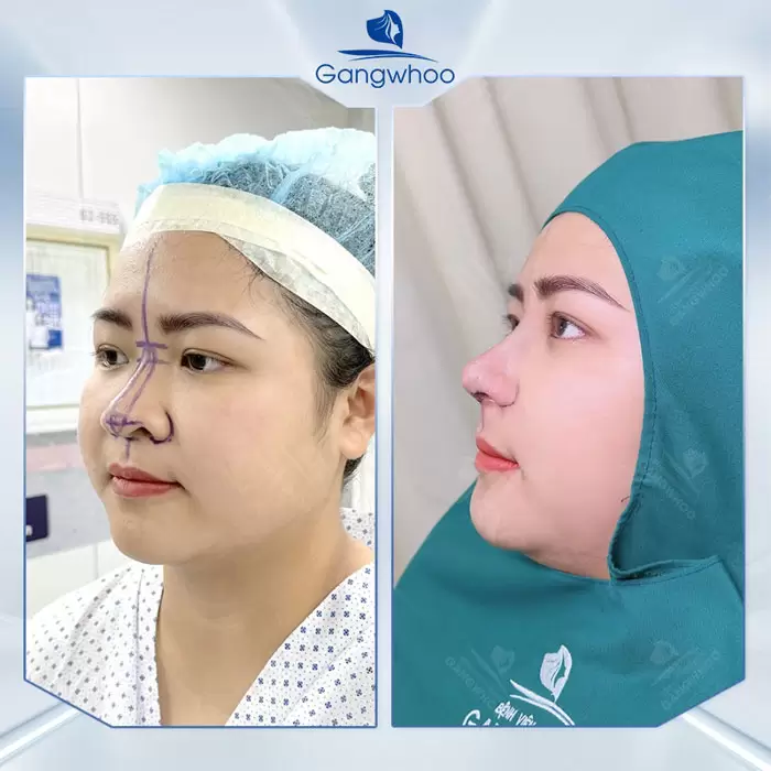 ru thu nho dau mui 7