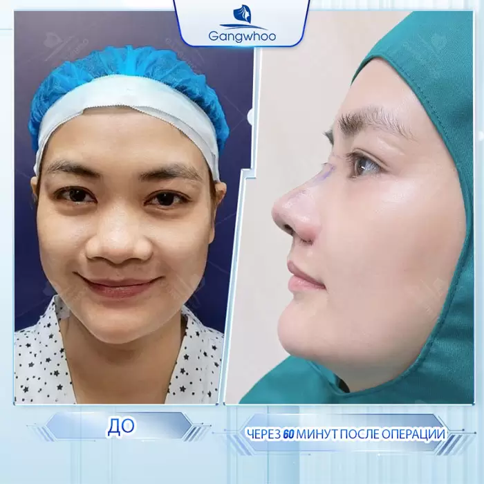 ru thu nho dau mui 8