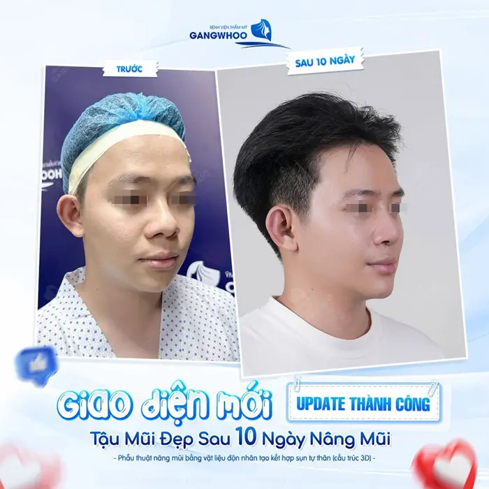 Giao diện mới update thành công sau 10 ngày thực hiện nhan sắc đẹp chấn động
