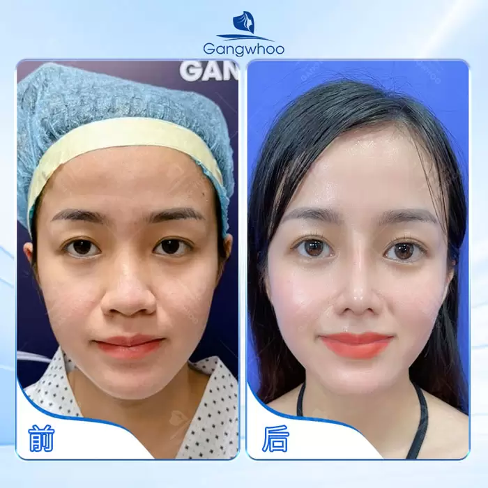 zh thu gon canh mui 1