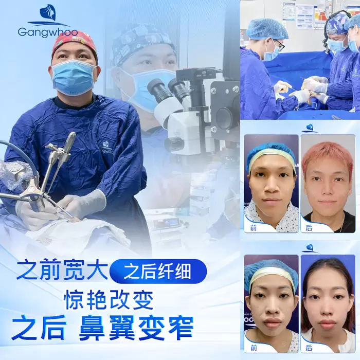 zh thu gon canh mui 2