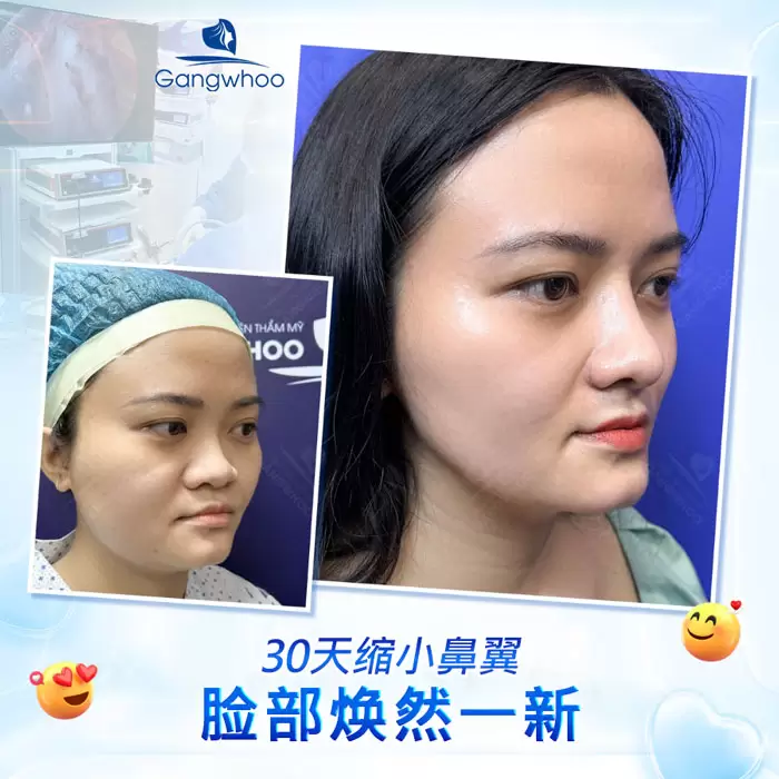 zh thu gon canh mui 3