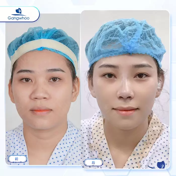 zh thu gon canh mui 5