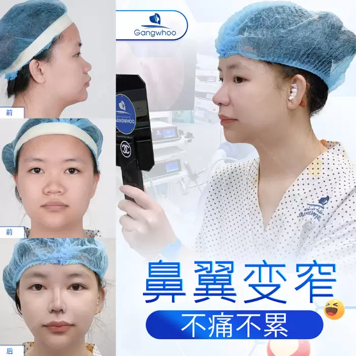 zh thu gon canh mui 6