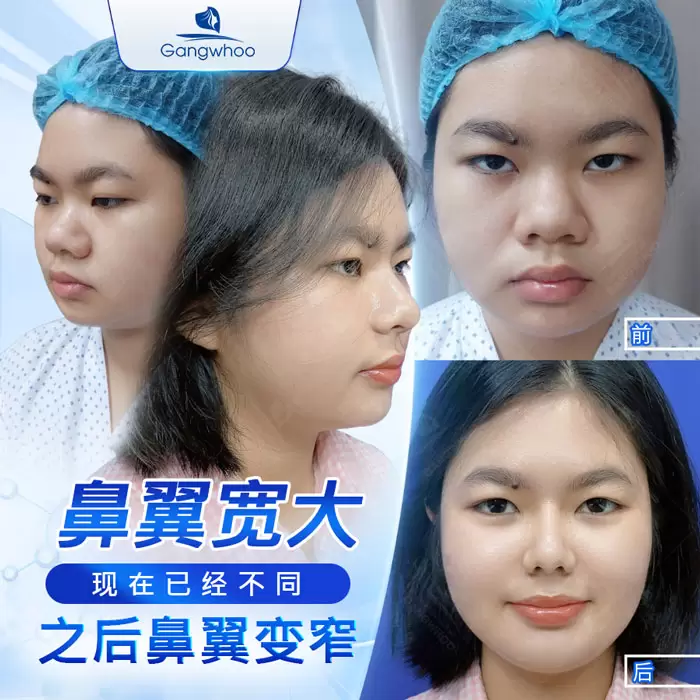 zh thu gon canh mui 8